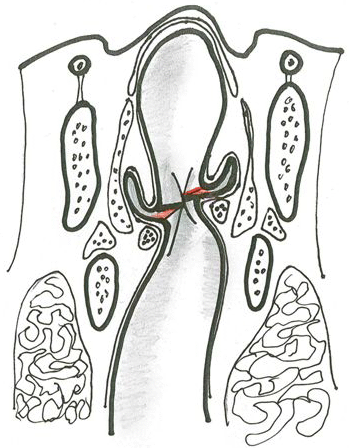 Fig. 7 dossier Alterazioni Cervicali prodotto dalla dottoressa Maria Elena Berioli